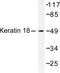 Keratin 18 antibody, LS-C176096, Lifespan Biosciences, Western Blot image 