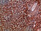 C-X-C Motif Chemokine Receptor 1 antibody, STJ99002, St John