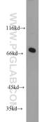 WW Domain Binding Protein 11 antibody, 10316-1-AP, Proteintech Group, Western Blot image 