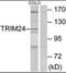 Tripartite Motif Containing 24 antibody, orb96494, Biorbyt, Western Blot image 