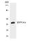 Ret Finger Protein Like 4A antibody, LS-C200588, Lifespan Biosciences, Western Blot image 