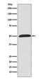 Wnt Family Member 5A antibody, M00549, Boster Biological Technology, Western Blot image 