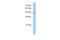 Patatin Like Phospholipase Domain Containing 5 antibody, PA5-69565, Invitrogen Antibodies, Western Blot image 