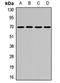 Kelch Like Family Member 9 antibody, LS-C668413, Lifespan Biosciences, Western Blot image 