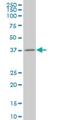 Annexin A10 antibody, H00011199-M03, Novus Biologicals, Western Blot image 