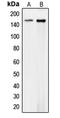 Collagen Type IV Alpha 1 Chain antibody, LS-C352029, Lifespan Biosciences, Western Blot image 