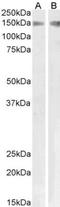 PLA2-R antibody, NBP1-46116, Novus Biologicals, Western Blot image 