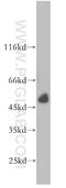 Proline Rich 5 antibody, 17948-1-AP, Proteintech Group, Western Blot image 