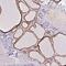 Protein Kinase C Substrate 80K-H antibody, NBP2-38511, Novus Biologicals, Immunohistochemistry paraffin image 
