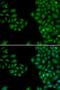 Neurofilament Light antibody, LS-C330877, Lifespan Biosciences, Immunofluorescence image 