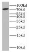 Mitochondrial TRNA Translation Optimization 1 antibody, FNab05416, FineTest, Western Blot image 