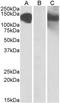 Cadherin 11 antibody, NBP1-52045, Novus Biologicals, Western Blot image 