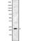 Adenylate Kinase 5 antibody, abx148094, Abbexa, Western Blot image 