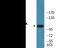 Protein Tyrosine Kinase 2 antibody, EKC2068, Boster Biological Technology, Western Blot image 