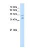 Pregnancy Specific Beta-1-Glycoprotein 1 antibody, NBP1-58028, Novus Biologicals, Western Blot image 