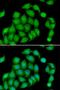 Aspartate Beta-Hydroxylase antibody, LS-C346126, Lifespan Biosciences, Immunofluorescence image 