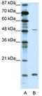 Fibrillin 1 antibody, TA335164, Origene, Western Blot image 