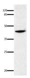 Interleukin 18 Binding Protein antibody, orb107336, Biorbyt, Western Blot image 