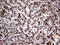 Erb-B2 Receptor Tyrosine Kinase 4 antibody, LS-C793883, Lifespan Biosciences, Immunohistochemistry paraffin image 