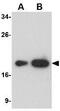 Lymphocyte Antigen 96 antibody, GTX85121, GeneTex, Western Blot image 