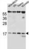 T Cell Receptor Beta Variable 7-9 antibody, abx026649, Abbexa, Western Blot image 