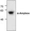 Amylase Alpha 1C (Salivary) antibody, TA318858, Origene, Western Blot image 