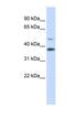 Metabolism Of Cobalamin Associated D antibody, NBP1-54708, Novus Biologicals, Western Blot image 