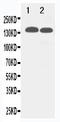 Tight Junction Protein 2 antibody, LS-C313092, Lifespan Biosciences, Western Blot image 