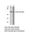 Zeta Chain Of T Cell Receptor Associated Protein Kinase 70 antibody, PA5-36018, Invitrogen Antibodies, Western Blot image 