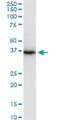 Serine Protease 8 antibody, H00005652-M11A, Novus Biologicals, Western Blot image 