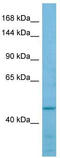 Formin Like 2 antibody, TA337941, Origene, Western Blot image 