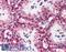 MutS Homolog 2 antibody, LS-B1973, Lifespan Biosciences, Immunohistochemistry paraffin image 