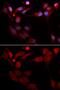 Amyloid Beta Precursor Protein Binding Family B Member 1 antibody, GTX30053, GeneTex, Immunofluorescence image 