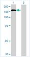 Trafficking Protein Particle Complex 10 antibody, H00007109-B01P-50ug, Novus Biologicals, Western Blot image 