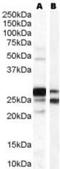 Catechol-O-Methyltransferase antibody, orb92686, Biorbyt, Western Blot image 