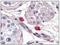 FceRIa antibody, SM2251P, Origene, Immunohistochemistry frozen image 