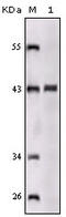 Sortilin Related Receptor 1 antibody, STJ98393, St John