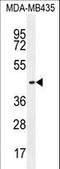 Olfactory Receptor Family 2 Subfamily L Member 13 antibody, LS-C163168, Lifespan Biosciences, Western Blot image 