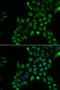 Tetraspanin 7 antibody, STJ28500, St John