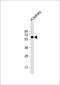 Electron Transfer Flavoprotein Dehydrogenase antibody, 62-516, ProSci, Western Blot image 