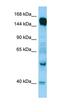Rap Guanine Nucleotide Exchange Factor 6 antibody, orb326568, Biorbyt, Western Blot image 