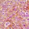 Gamma-Aminobutyric Acid Type A Receptor Beta1 Subunit antibody, LS-C356048, Lifespan Biosciences, Immunohistochemistry frozen image 