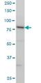 SMAD Specific E3 Ubiquitin Protein Ligase 1 antibody, ab57573, Abcam, Western Blot image 