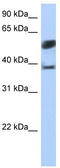 Speckle Type BTB/POZ Protein Like antibody, TA342109, Origene, Western Blot image 
