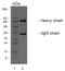 Leucine Rich Repeat Containing G Protein-Coupled Receptor 4 antibody, AM32985PU-N, Origene, Western Blot image 