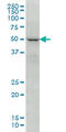 Forkhead Box C2 antibody, LS-C104948, Lifespan Biosciences, Western Blot image 