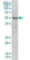 Forkhead box protein C2 antibody, LS-C104948, Lifespan Biosciences, Western Blot image 