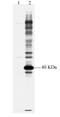 Acid Phosphatase antibody, ab16389, Abcam, Western Blot image 