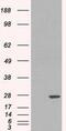 Glutathione S-Transferase Pi 1 antibody, GTX89536, GeneTex, Western Blot image 