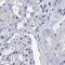 Hemogen antibody, PA5-54028, Invitrogen Antibodies, Immunohistochemistry paraffin image 